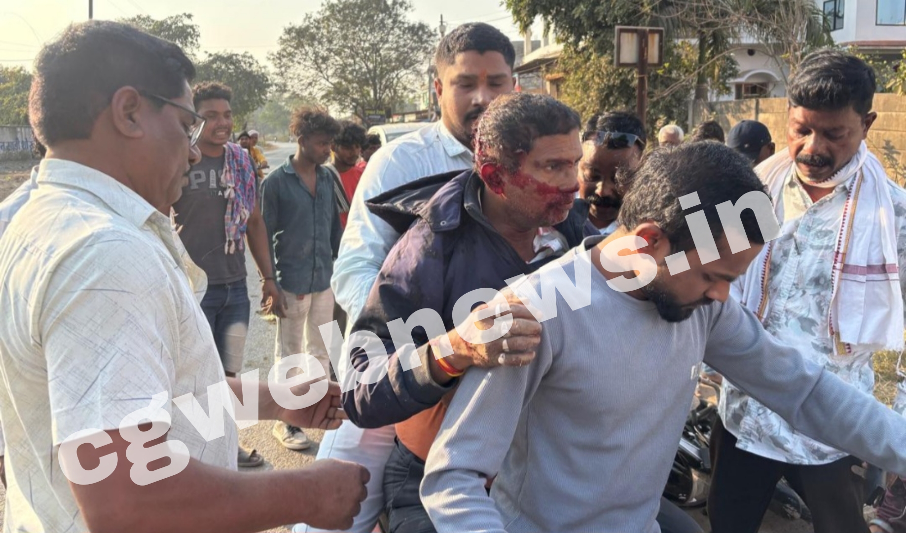 सक्ती - वार्ड क्रमांक 11 के पूर्व कांग्रेस पार्षद प्रत्यासी छेडूराम देवांगन हुए सड़क हादसे का शिकार, हालत गंभीर