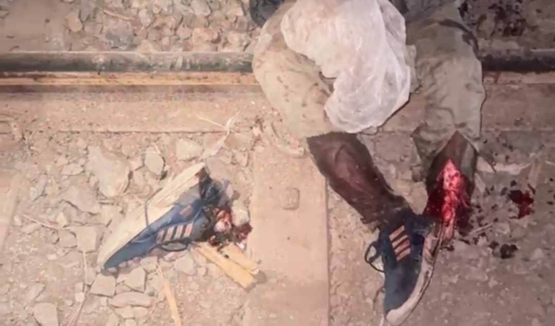 सक्ती रेलवे स्टेशन में हादसा, मालगाड़ी से कट कर युवक का पैर हुआ अलग, भीतर देखे तश्वीर