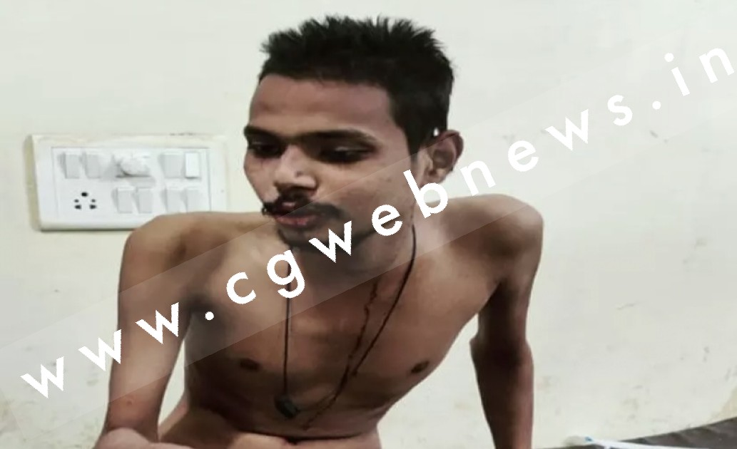 छत्तीसगढ़ में बही उल्टी गंगा , EX गर्लफ्रेंड ने अपने EX ब्वॉयफ्रेंड पर किया चाकू से हमला