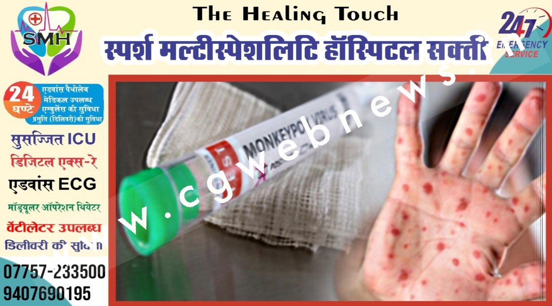 छत्तीसगढ़ - मंकिपॉक्स के संदिग्ध मरीज की जाँच रिपोर्ट आई सामने , रिपोर्ट के मुताबिक