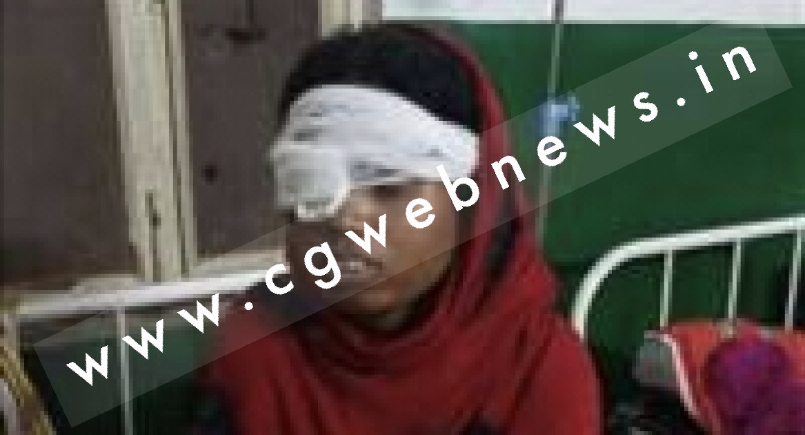 छत्तीसगढ़ - पति ने की क्रूरता की सभी हदें पार , मायके जाने के विवाद में पत्नी की निकाल दी एक आंख