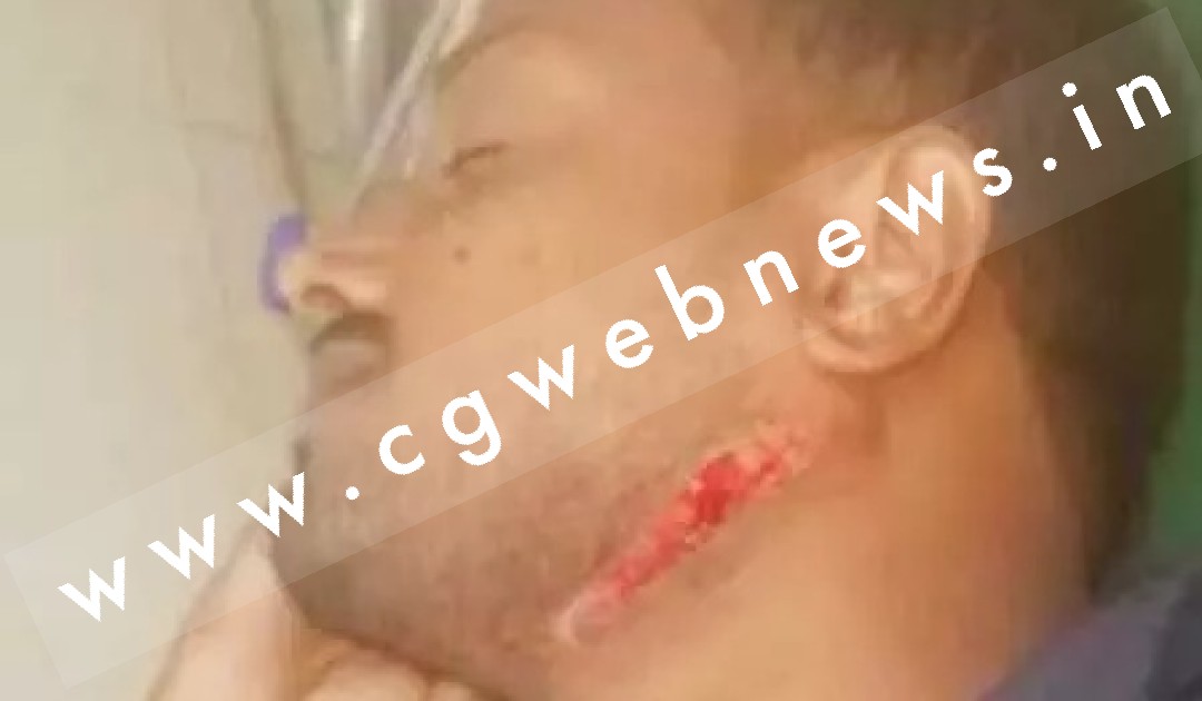 छत्तीसगढ़ - शराब पीने से मना करने पर आरक्षक के गले पर कटर से जानलेवा हमला , पुलिस जाँच में जुटी