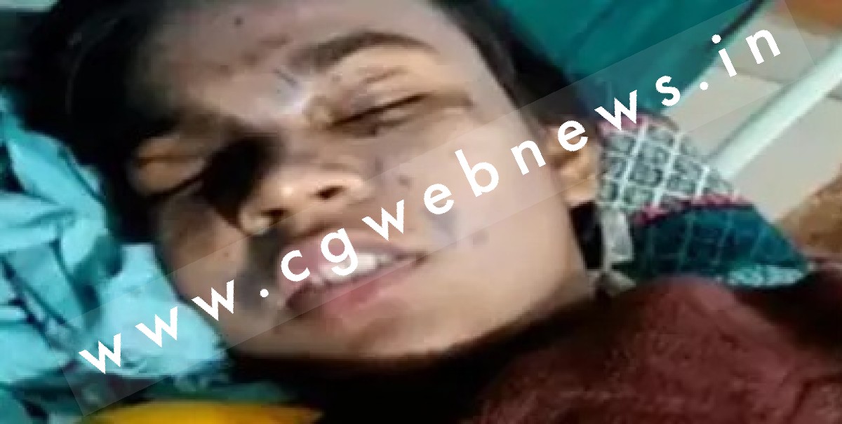 सक्ती जिले से बड़ी खबर , स्कूल के लैब में बड़ा हादसा , तेजाब से झुलसी छात्राएं , अपोलो हॉस्पिटल किया गया रिफर 