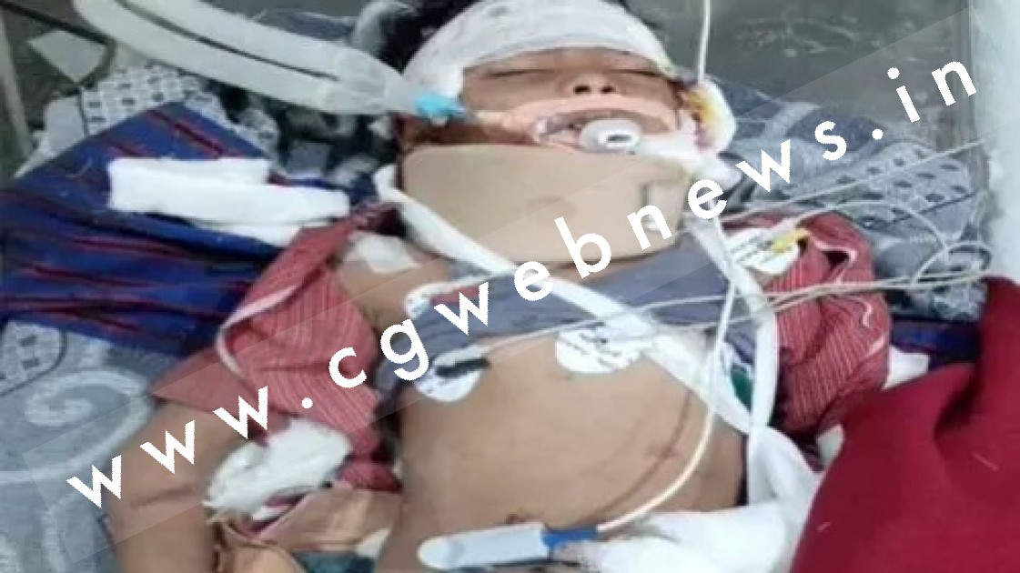 छत्तीसगढ़ - सड़क हादसे में घायल 8वे बच्चे की भी मौत , ट्रक और ऑटो की टक्कर में 07 बच्चो की पहले ही हो चुकी है मौत