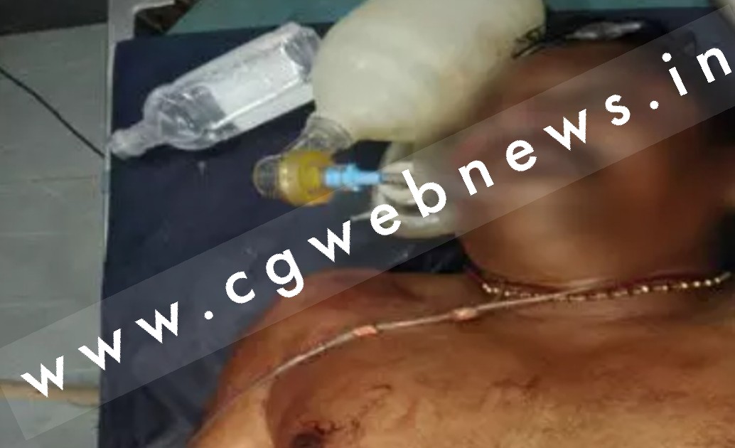 छत्तीसगढ़ - भाजपा नेता और उनके बेटे पर जानलेवा हमला , हमले में भाजपा नेता की मौत 