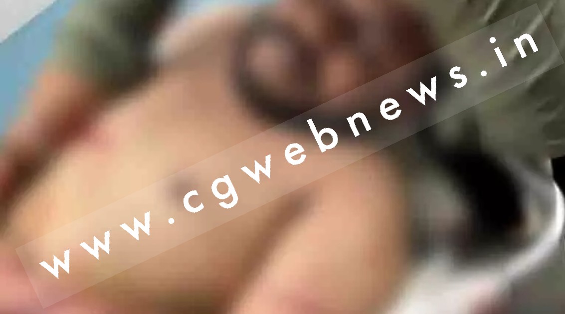 छत्तीसगढ़ में गैंगवार , मैडी ग्रुप और अकबर खान ग्रुप के बीच चले धारदार हथियार , एक घायल