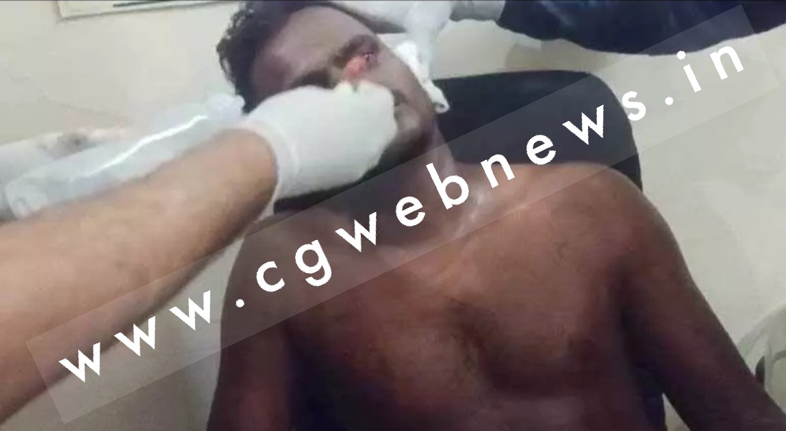 छत्तीसगढ़ - बीच सड़क पर हुई चाकूबाजी , एक युवक घायल , पुलिस आरोपियों की तलाश में जुटी