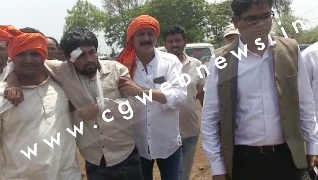 छत्तीसगढ़ - गोठनो के निरीक्षण पर गए भाजपा कार्यकर्ताओं पर हमला , कार्यकर्ताओं को आई चोट