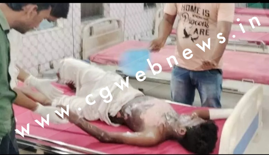 इंस्टाग्राम रील बनाने के लिए युवक ने दिया मौत को दावत , गंभीर हालत में हॉस्पिटल में भर्ती