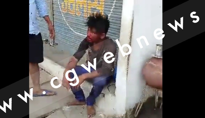 दिनदहाड़े भरे बाजार में सिरफिरे युवक ने युवती को मारा चाकू , युवती की हालत गंभीर