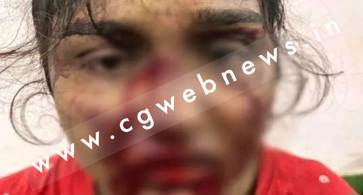 छत्तीसगढ़ - युवक और युवती पर चाकू से जानलेवा हमला , दोनो की हालत गंभीर