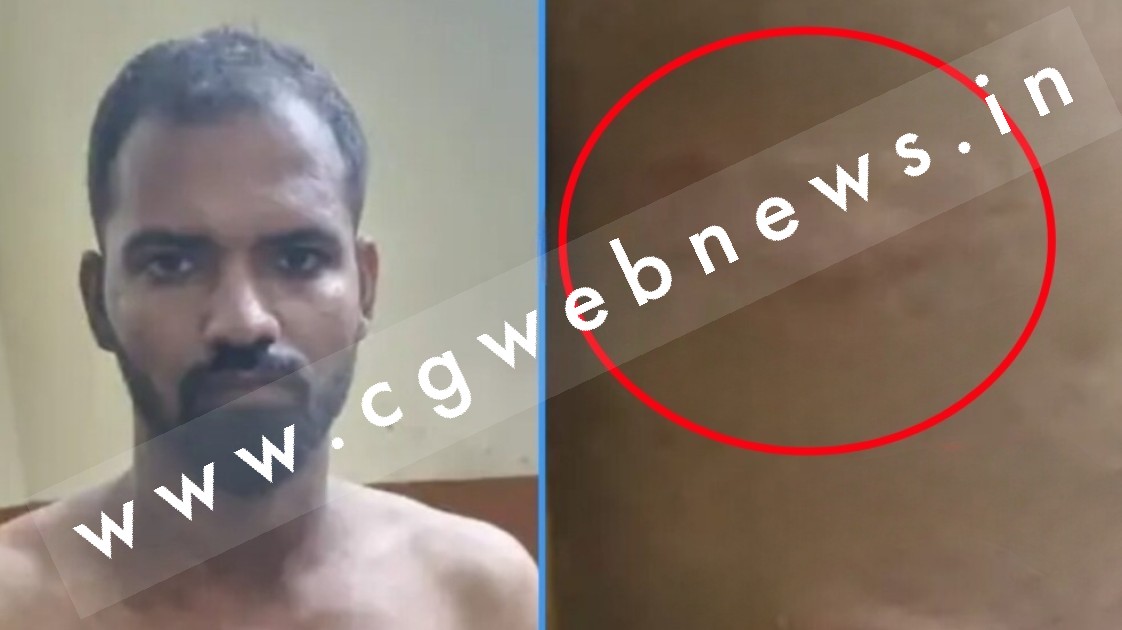 छत्तीसगढ़ - ASI के बेटे की पिटाई , जिस थाने में पिता की पोस्टिंग उसी थाने के सिपाहियों ने ASI के बेटे को बेरहमी से पीटा