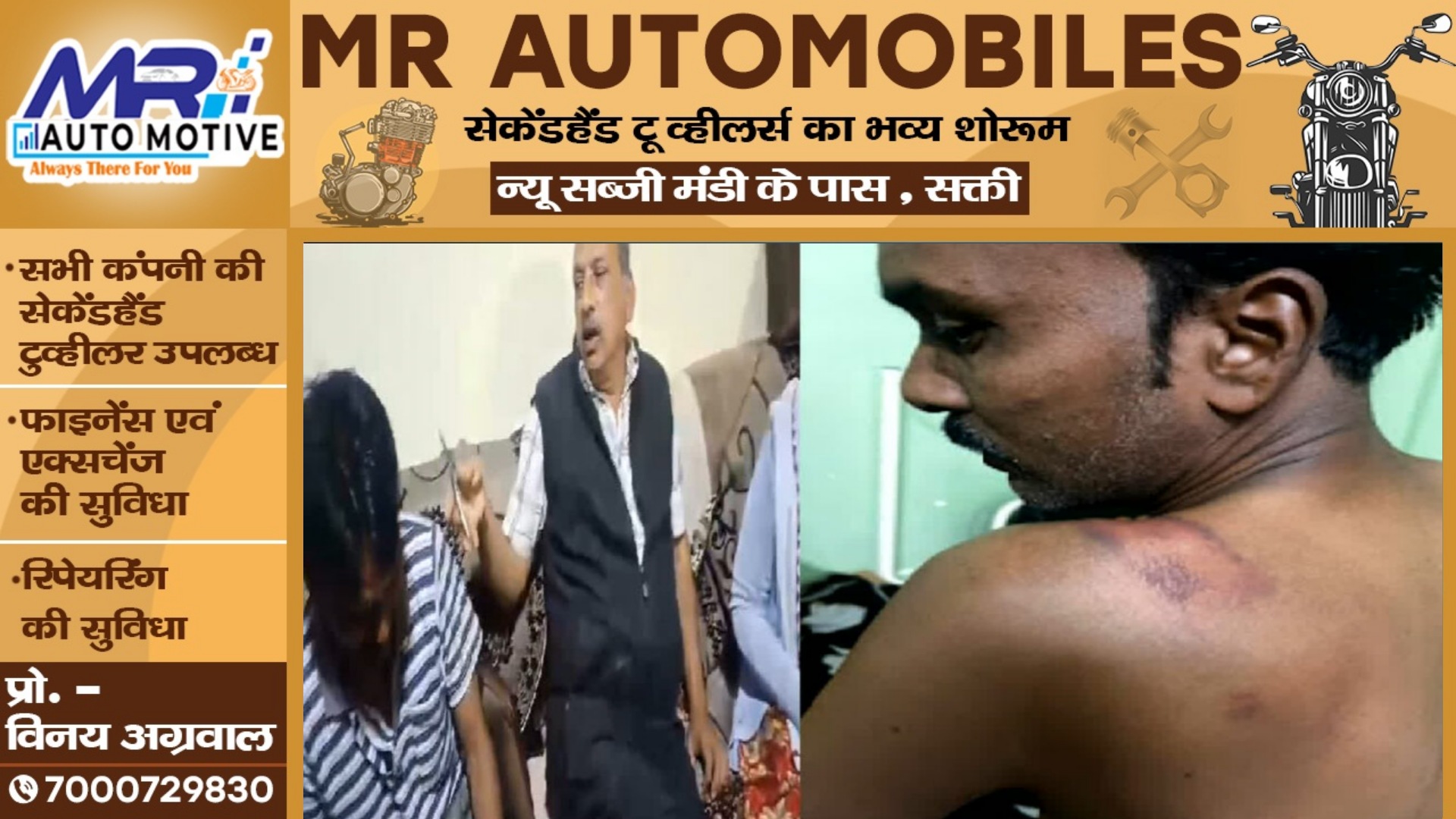 दलित युवक पर बरसी भाजपा नेता की लाठी , VIDEO वायरल होने के बाद भाजपा नेता सहित 07 गिरफ्तार