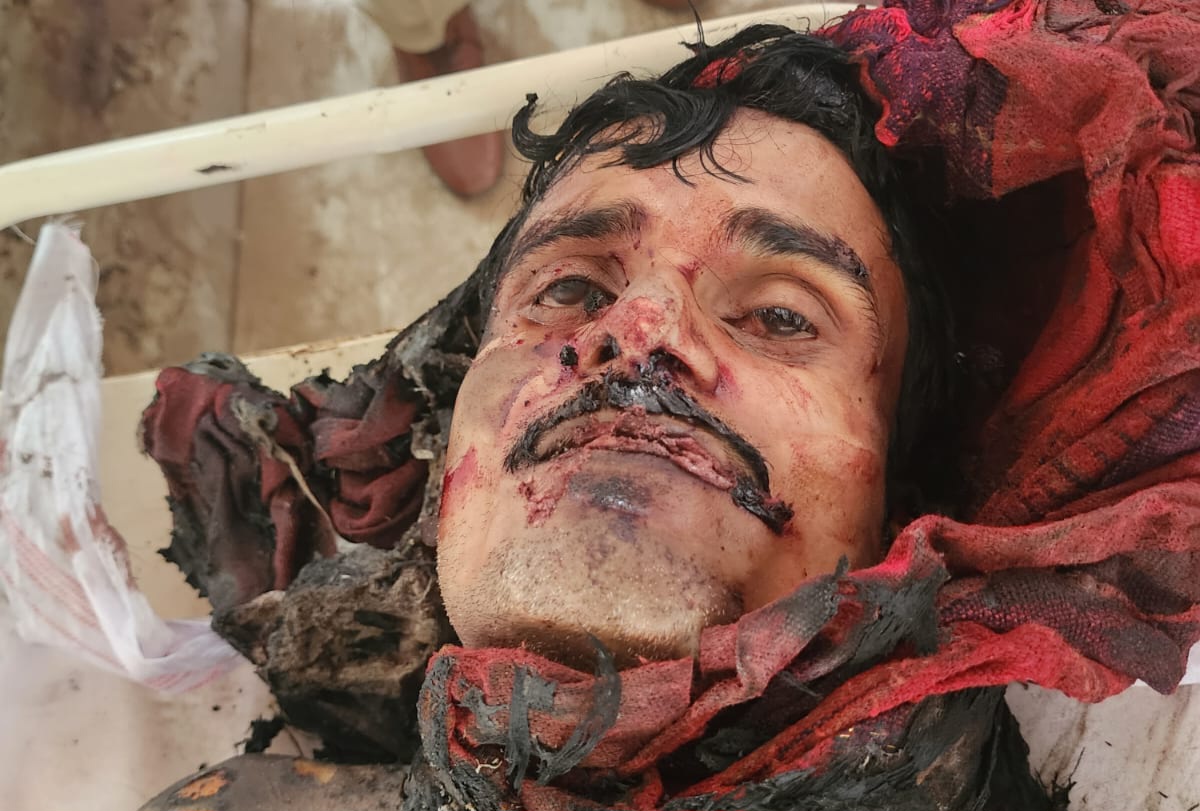 सक्ती - अधजली लाश की नही हो पा रही है पहचान , पहचान बताने के लिए पुलिस ने जारी किया नंबर , भीतर देखे तश्वीर