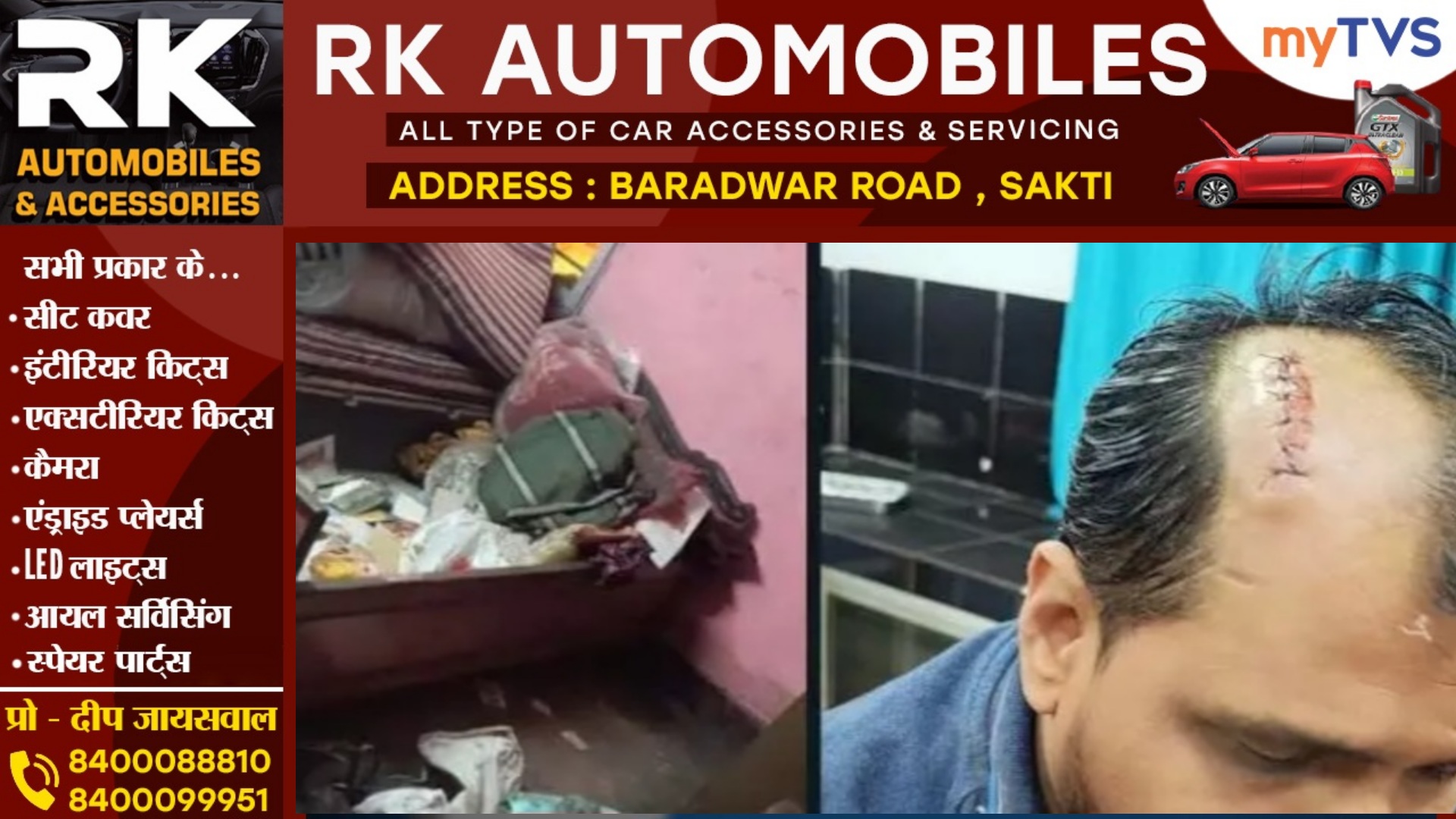 छत्तीसगढ़ - चोरी में असफल होने पर चोरों ने किया हमला , एक ब्यक्ति का सिर फटा